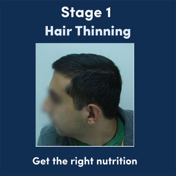 Man Matters Biotin Hair Gummies (60N) No Sugar