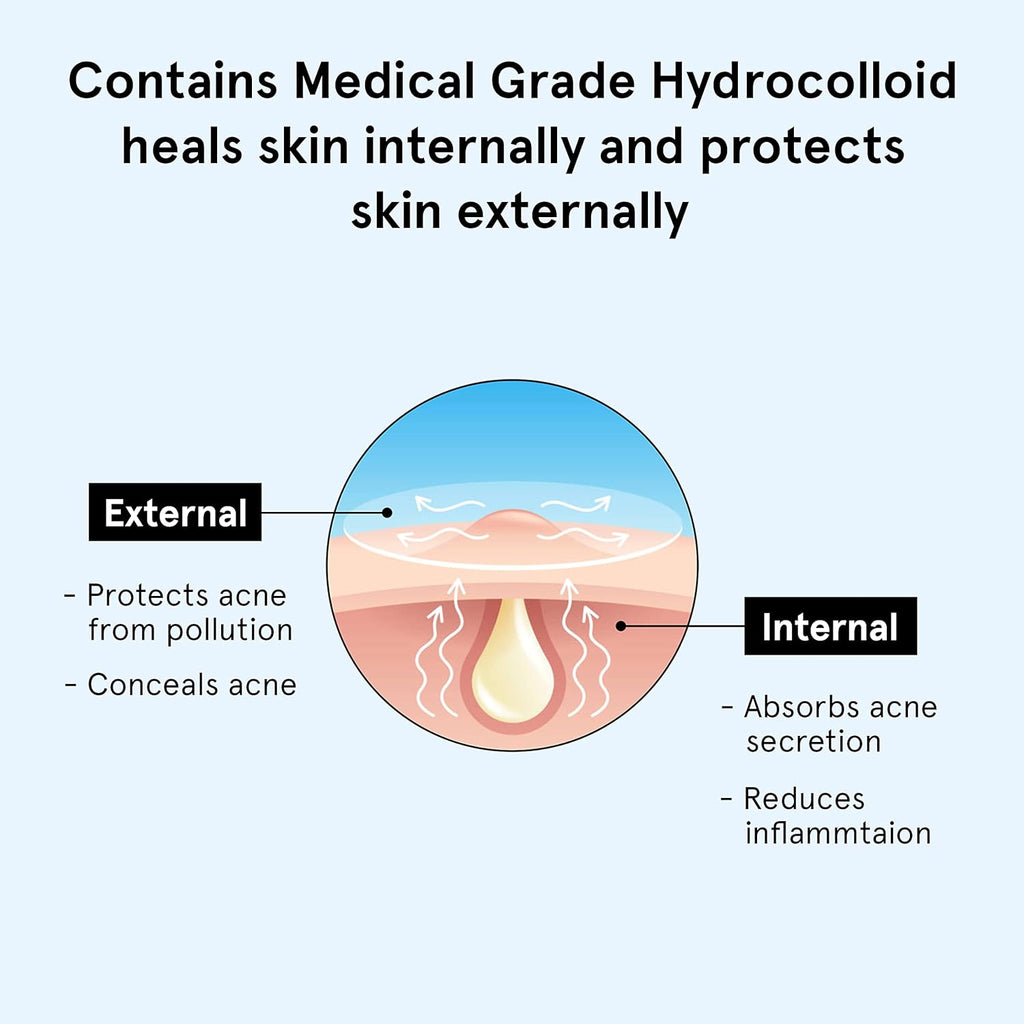 Be Bodywise Acne Pimple Patch