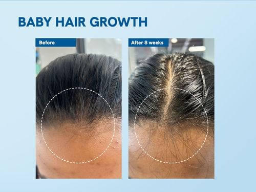 Be Bodywise Advanced Hair Growth Pack with Roll On (25ml)