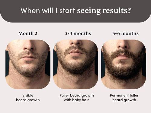 Man Matters Beard Gummies - 2 Months