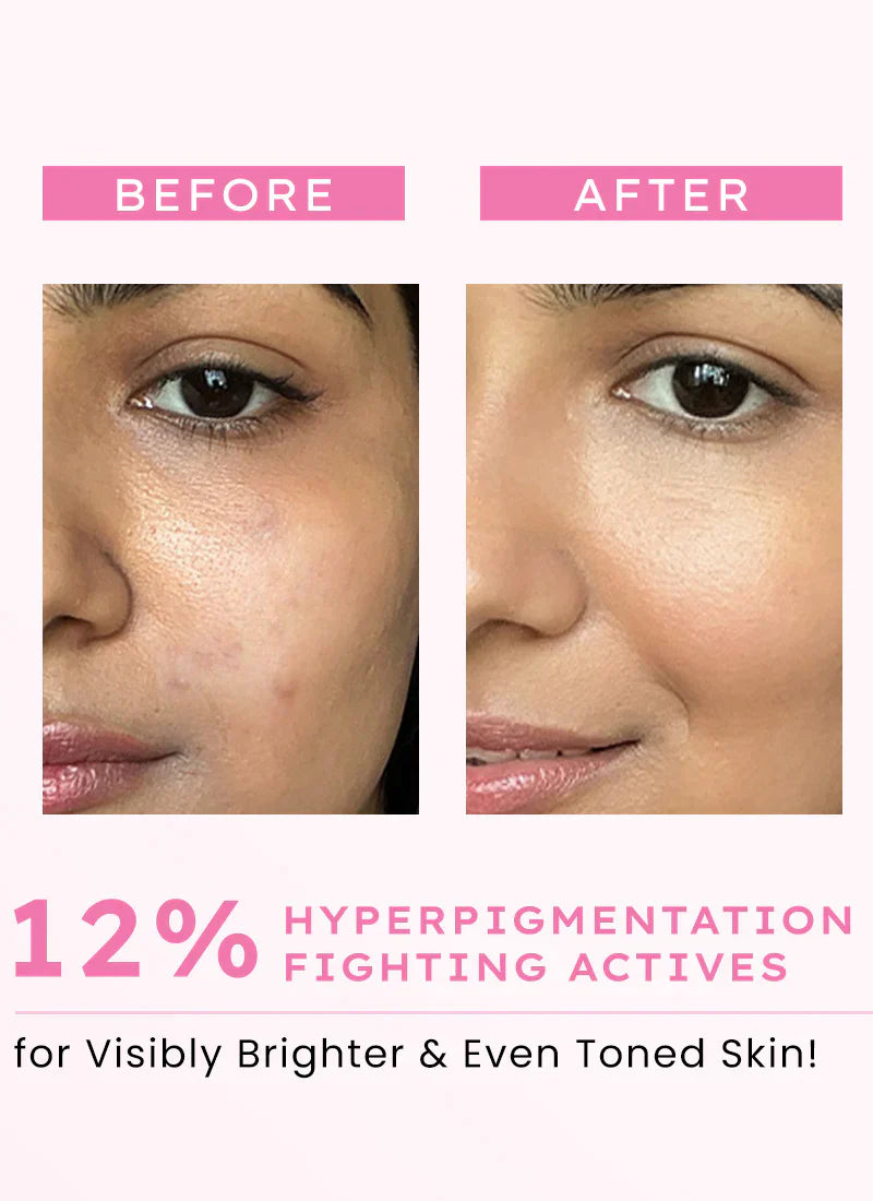 Hyphen Advanced De- Pigmentation Serum